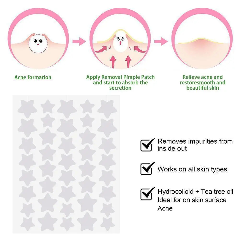 Hydrocolloid Pimple Patches – 40 Count, Star-Shaped & Invisible Acne Covers